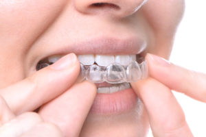 Advanced technology suite